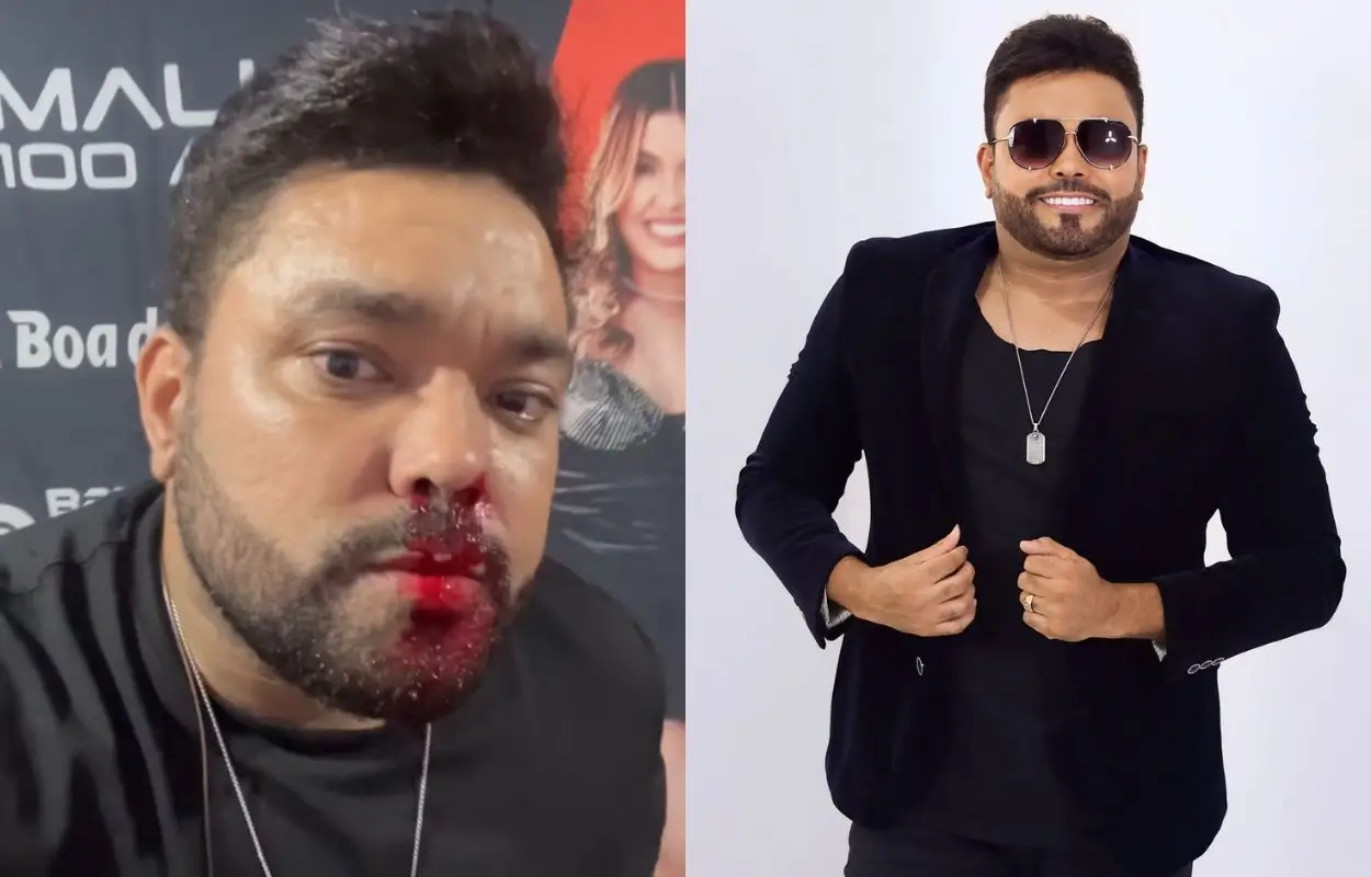 cantor de forró com curativo discreto na testa grava vídeo no camarim para tranquilizar fãs